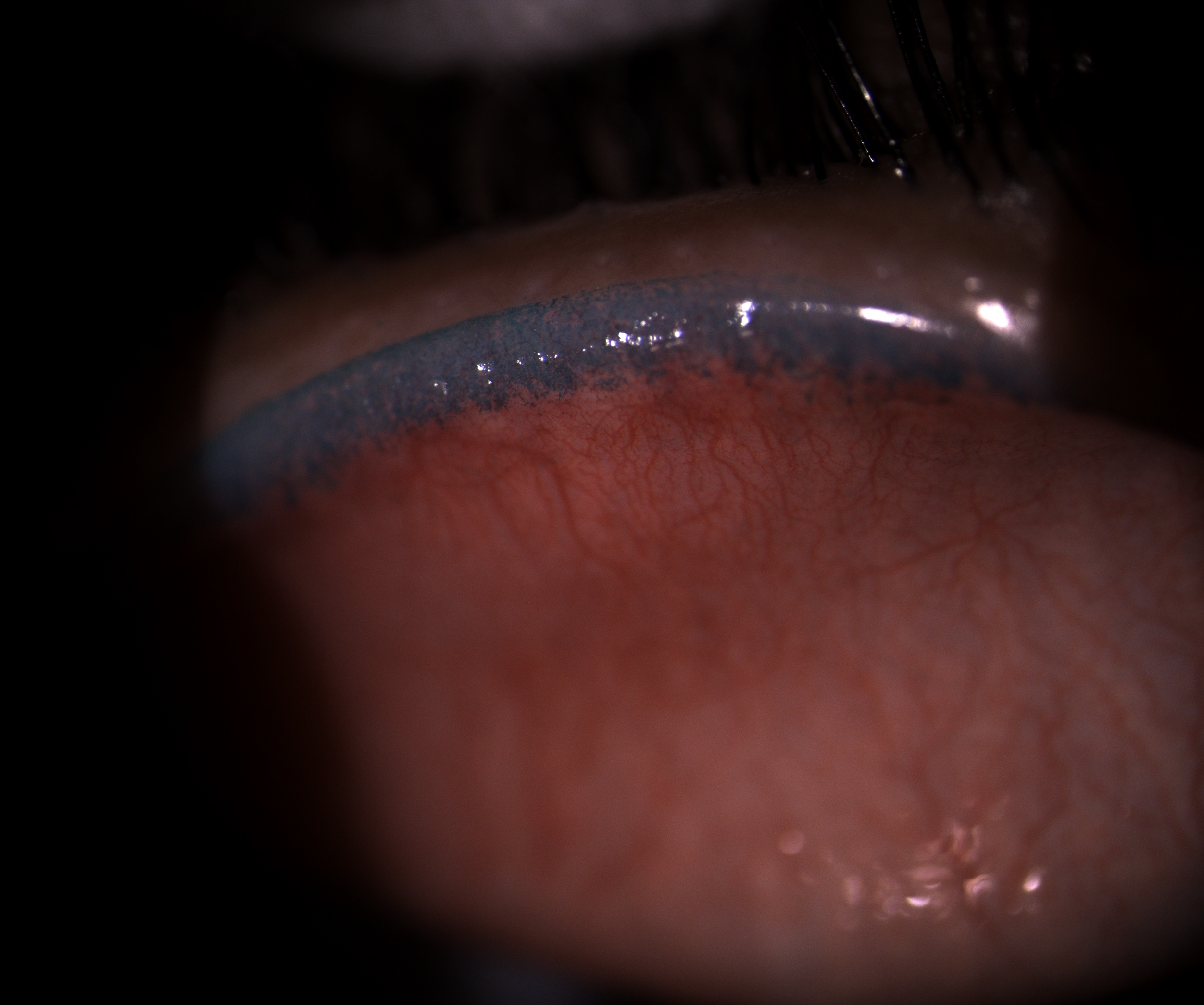 Resource Image